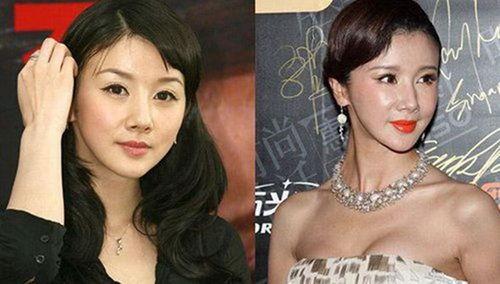 明星为何用硅胶,揭秘美容界的秘密武器