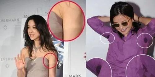 明星的狐臭怎么去除,告别狐臭，自信闪耀舞台